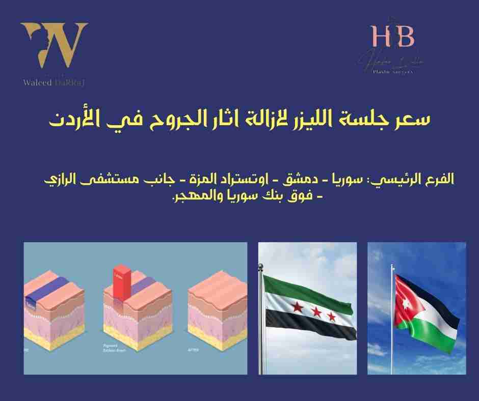 سعر جلسة الليزر لازالة اثار الجروح في الأردن