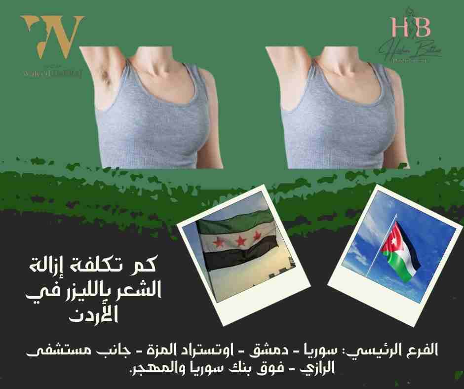 كم تكلفة إزالة الشعر بالليزر في الأردن