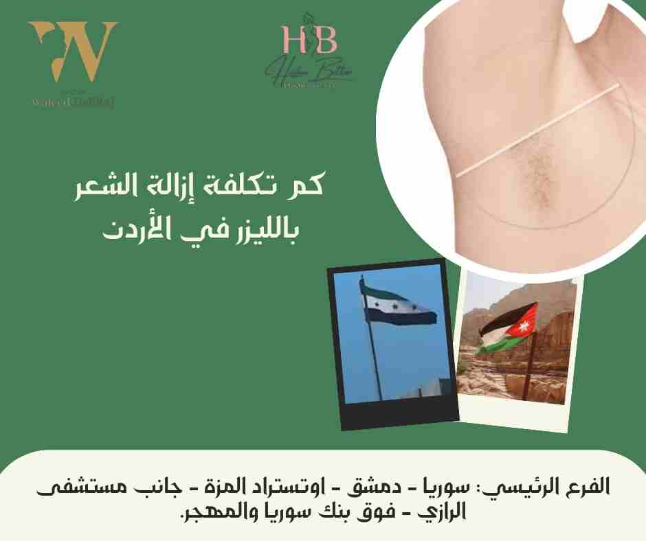 كم تكلفة إزالة الشعر بالليزر في الأردن
