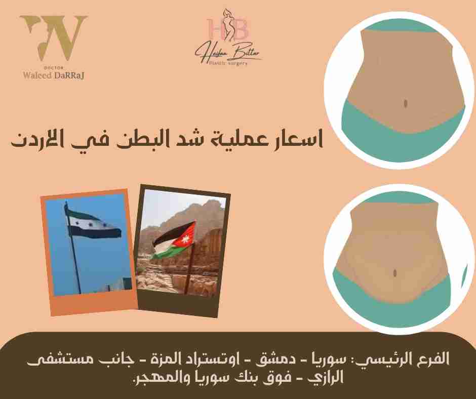 اسعار عملية شد البطن في الاردن