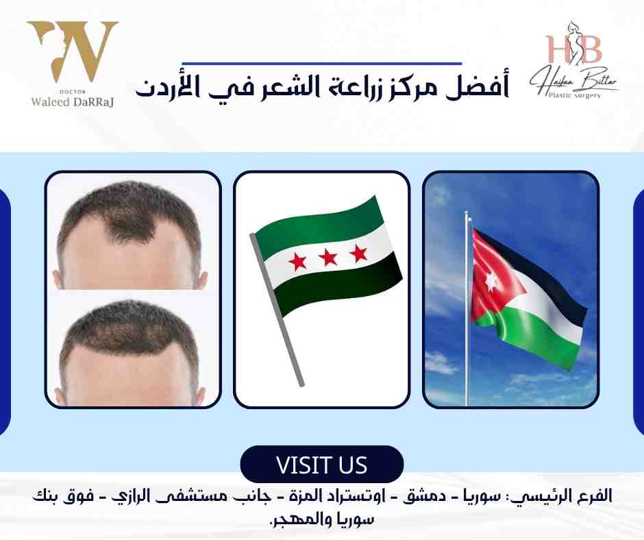 أفضل مركز زراعة الشعر في الأردن