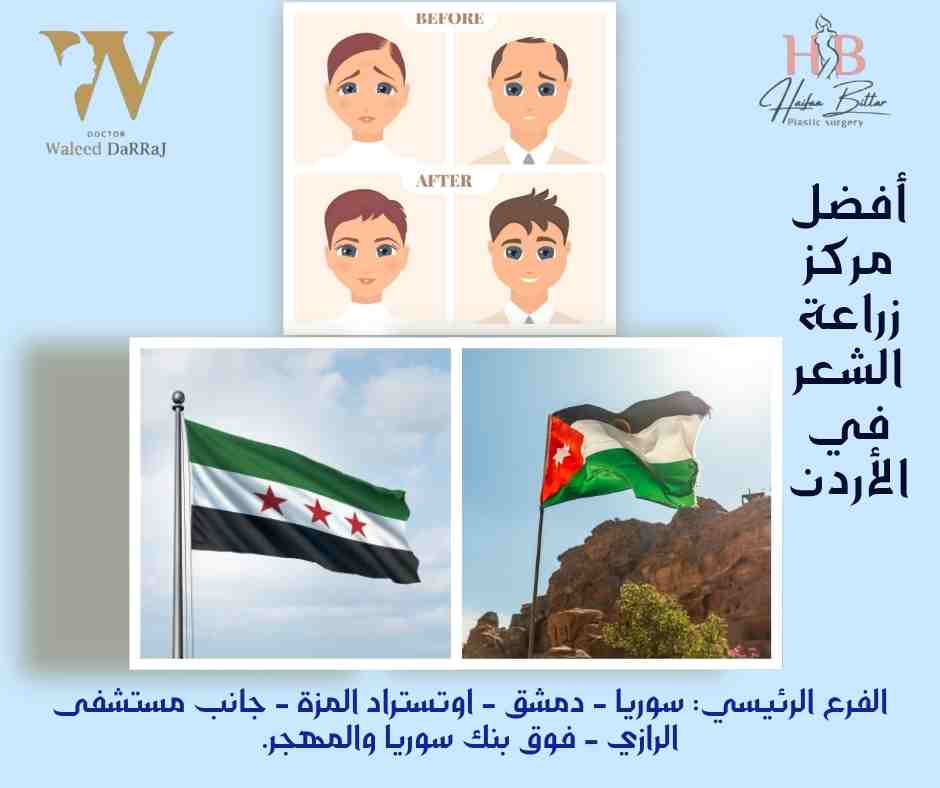 أفضل مركز زراعة الشعر في الأردن