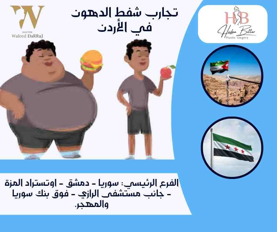 تجارب شفط الدهون في الأردن