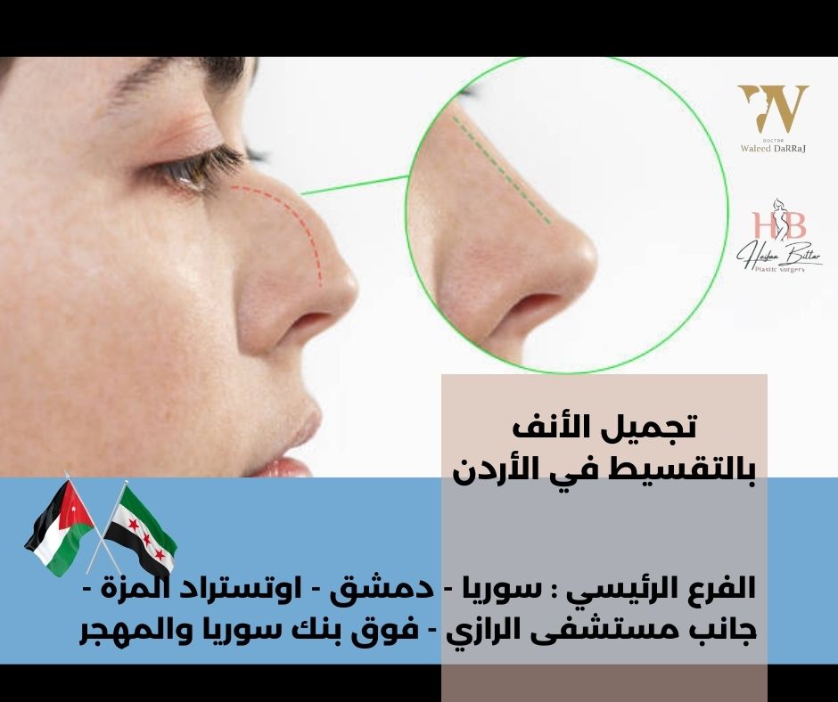 تجميل الأنف بالتقسيط في الأردن
