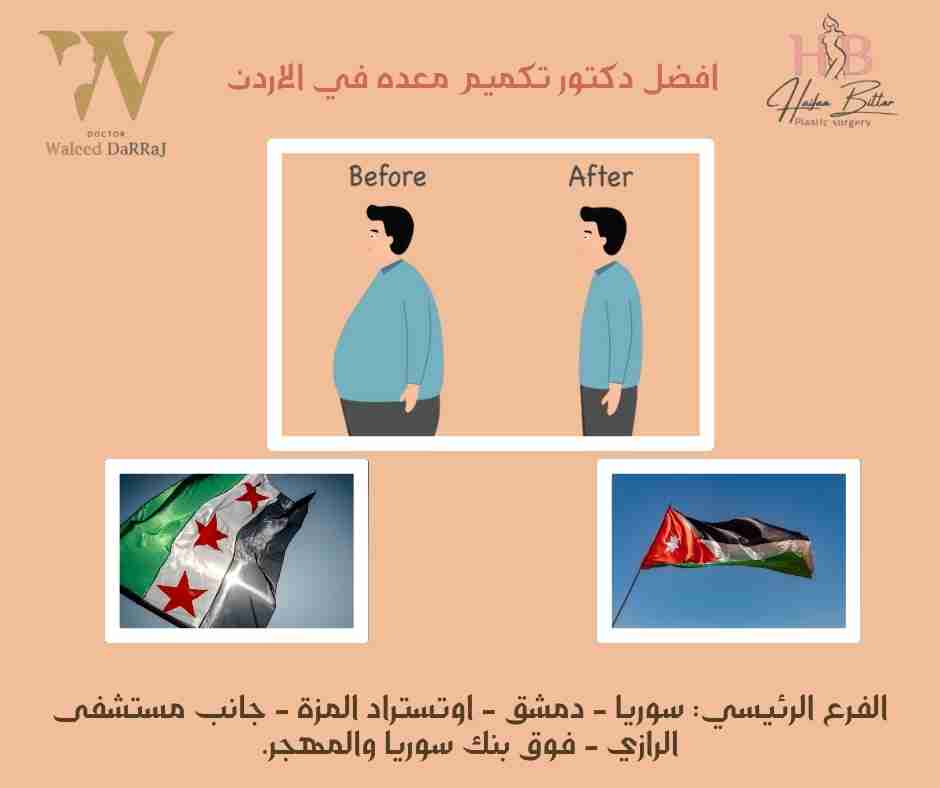 افضل دكتور تكميم معده في الاردن