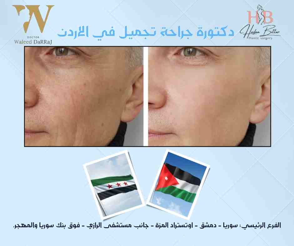 دكتورة جراحة تجميل في الاردن