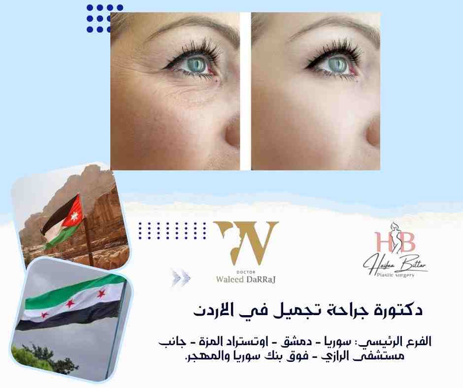 دكتورة جراحة تجميل في الاردن