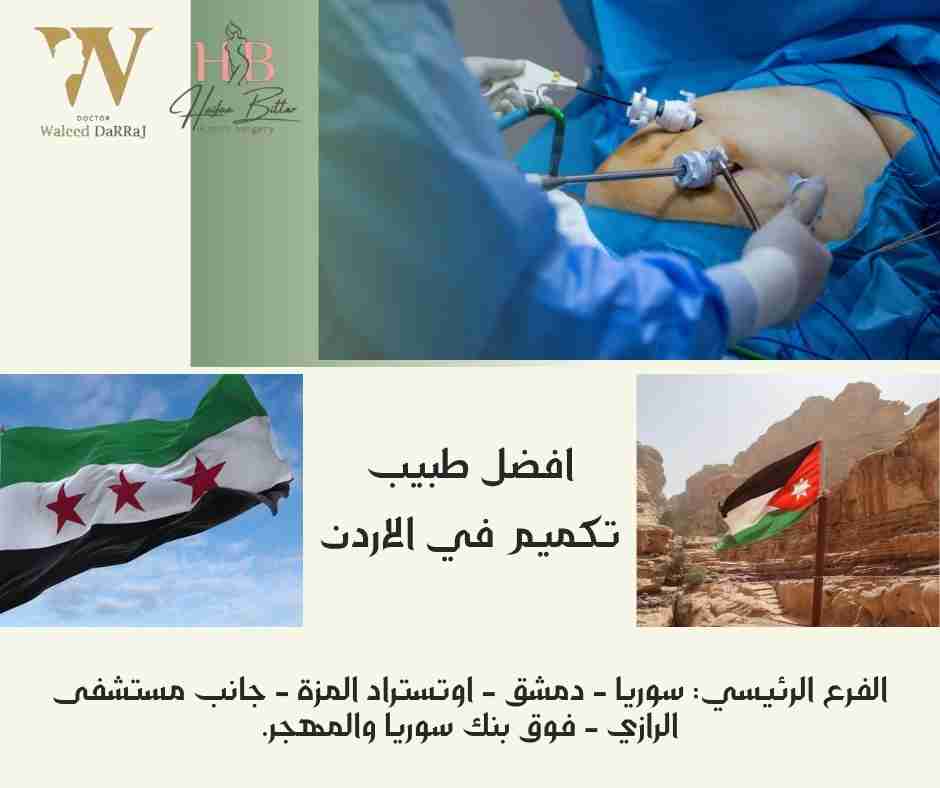 افضل طبيب تكميم في الاردن