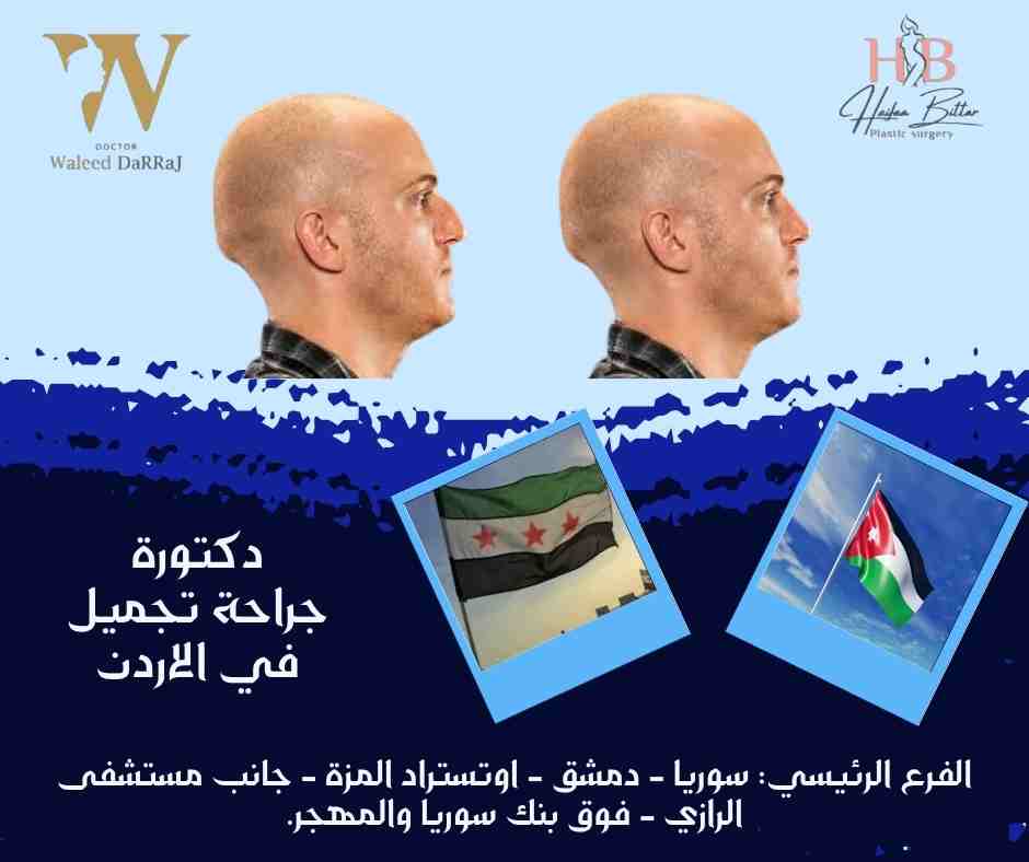 دكتورة جراحة تجميل في الاردن