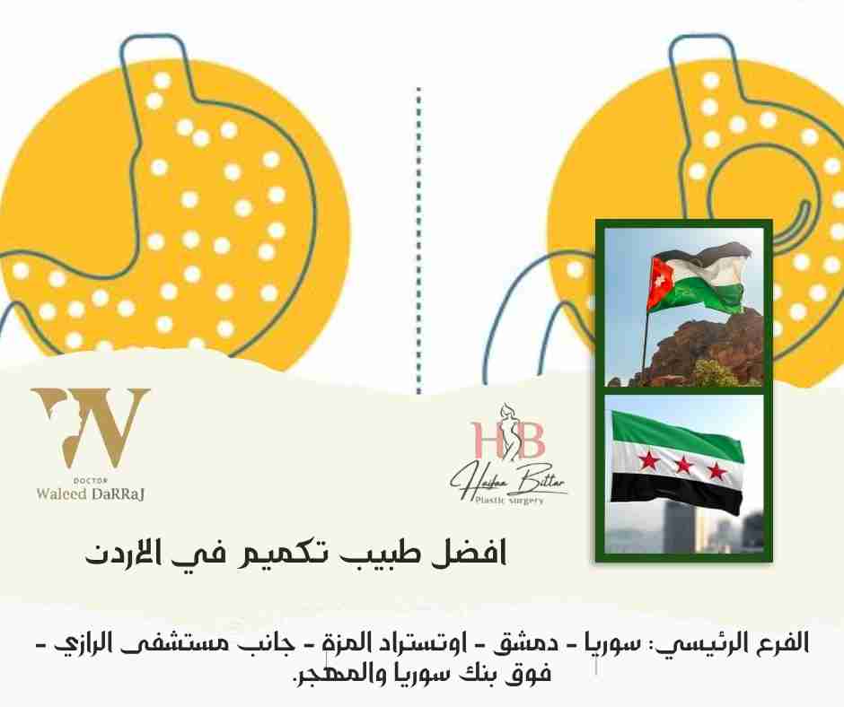 افضل طبيب تكميم في الاردن