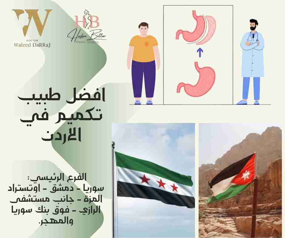 افضل طبيب تكميم في الاردن