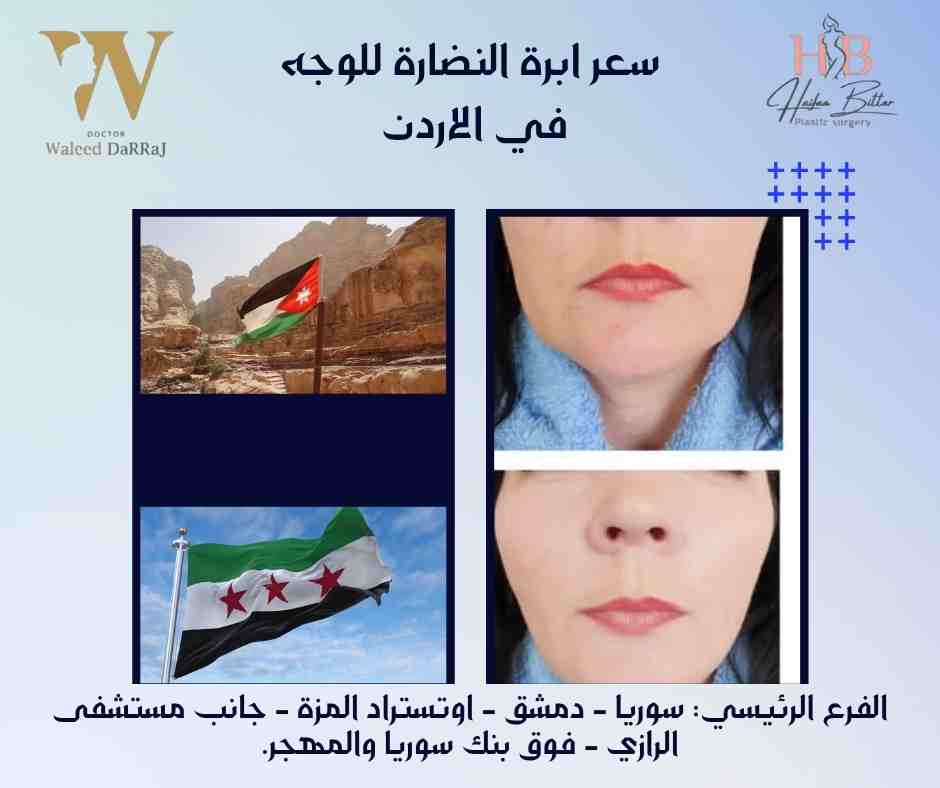 سعر ابرة النضارة للوجه في الاردن