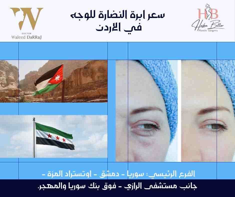 سعر ابرة النضارة للوجه في الاردن