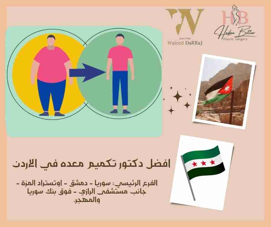 افضل دكتور تكميم معده في الاردن