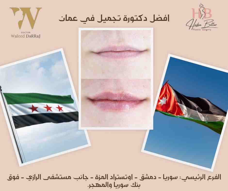 افضل دكتورة تجميل في عمان