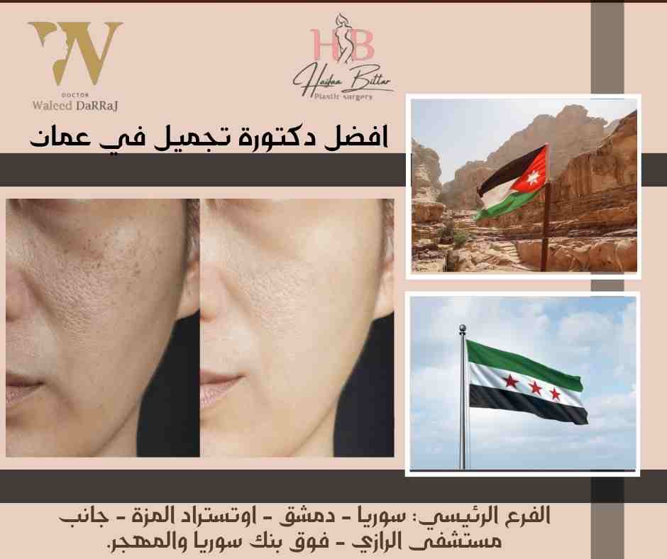 افضل دكتورة تجميل في عمان