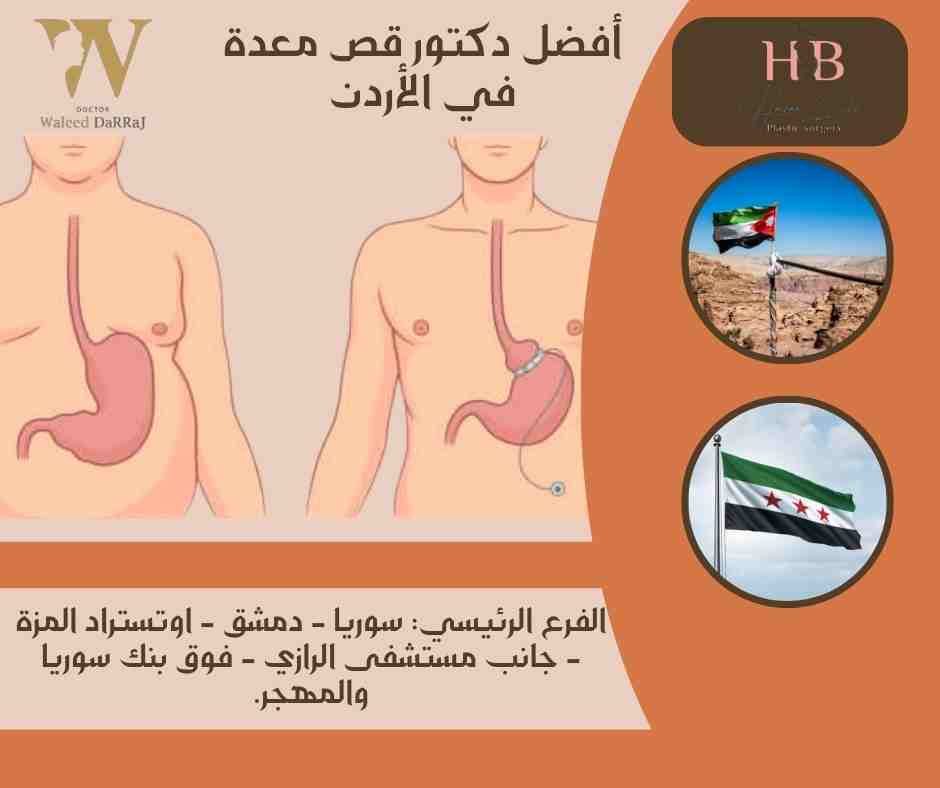أفضل دكتور قص معدة في الأردن