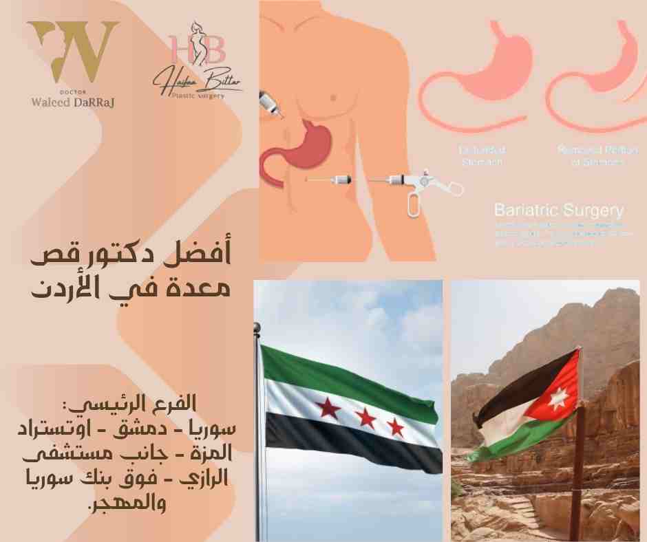 أفضل دكتور قص معدة في الأردن