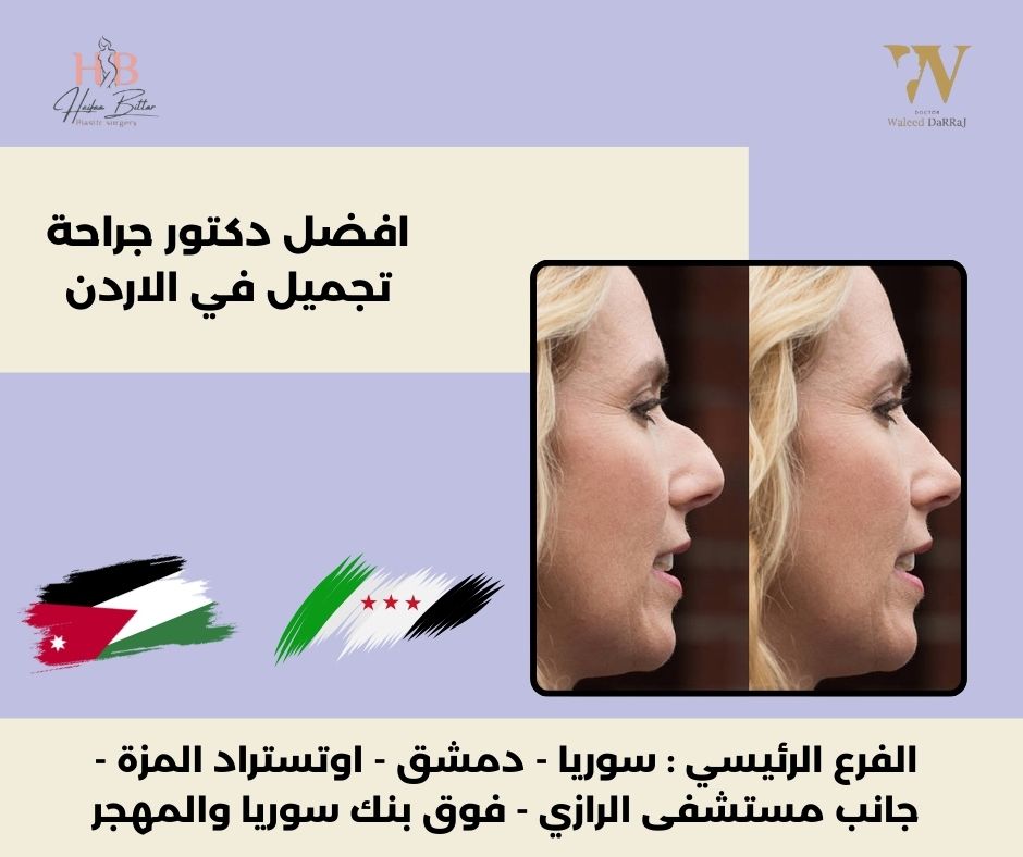افضل دكتور جراحة تجميل في الاردن