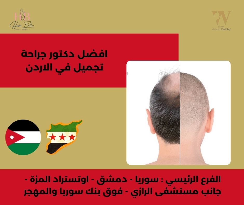 دكتور جراحة تجميل في الأردن