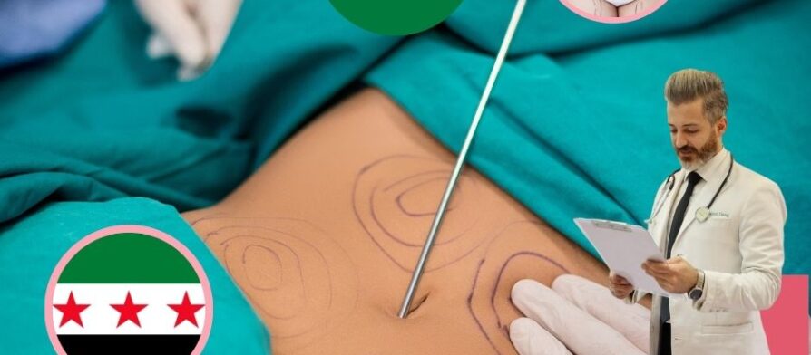 أسعار عمليات شفط الدهون في الأردن