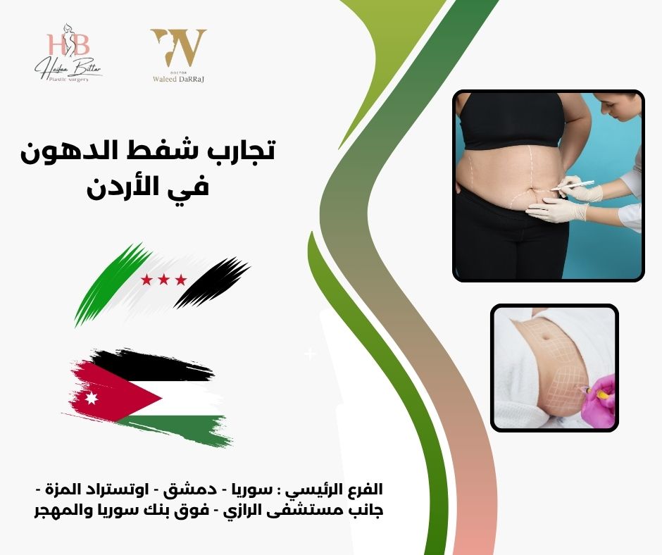 تجارب شفط الدهون في الاردن