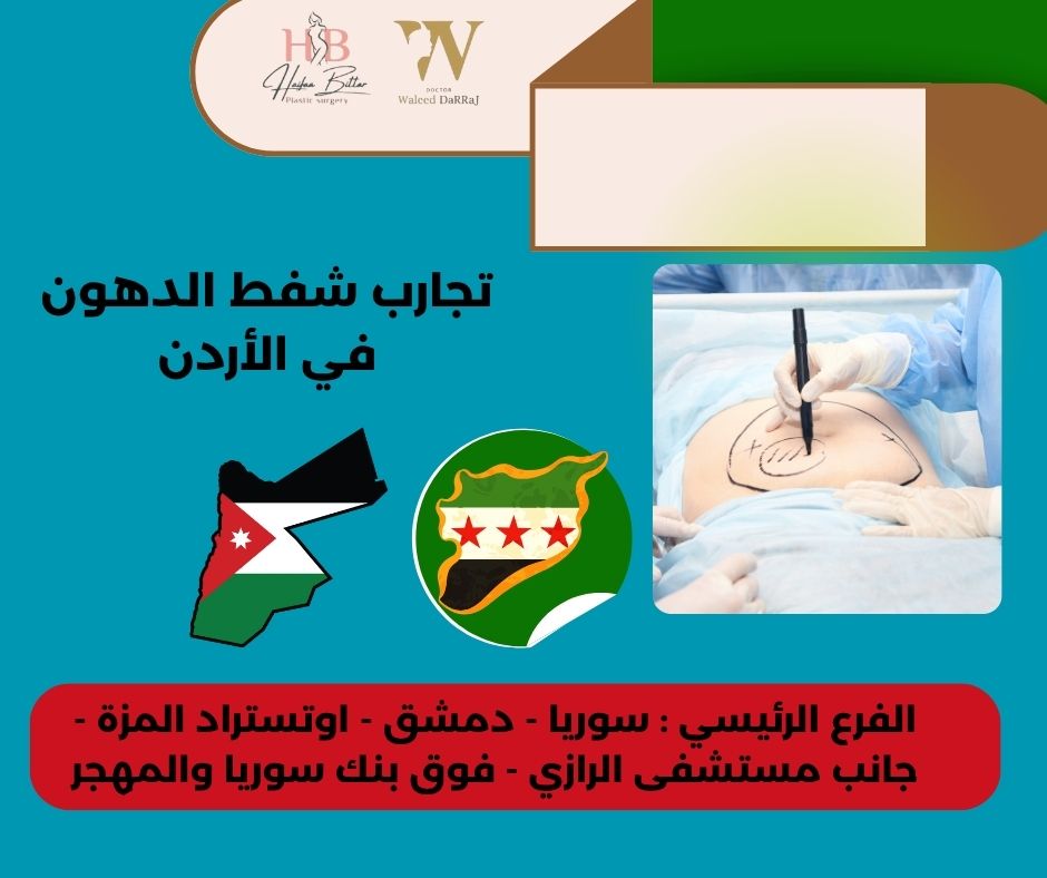 أسعار عمليات شفط الدهون في الأردن
