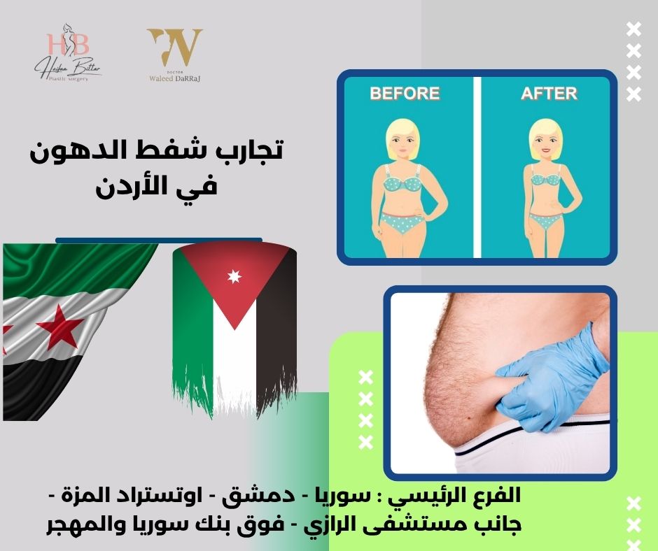 تكلفة عملية شفط الدهون في الأردن