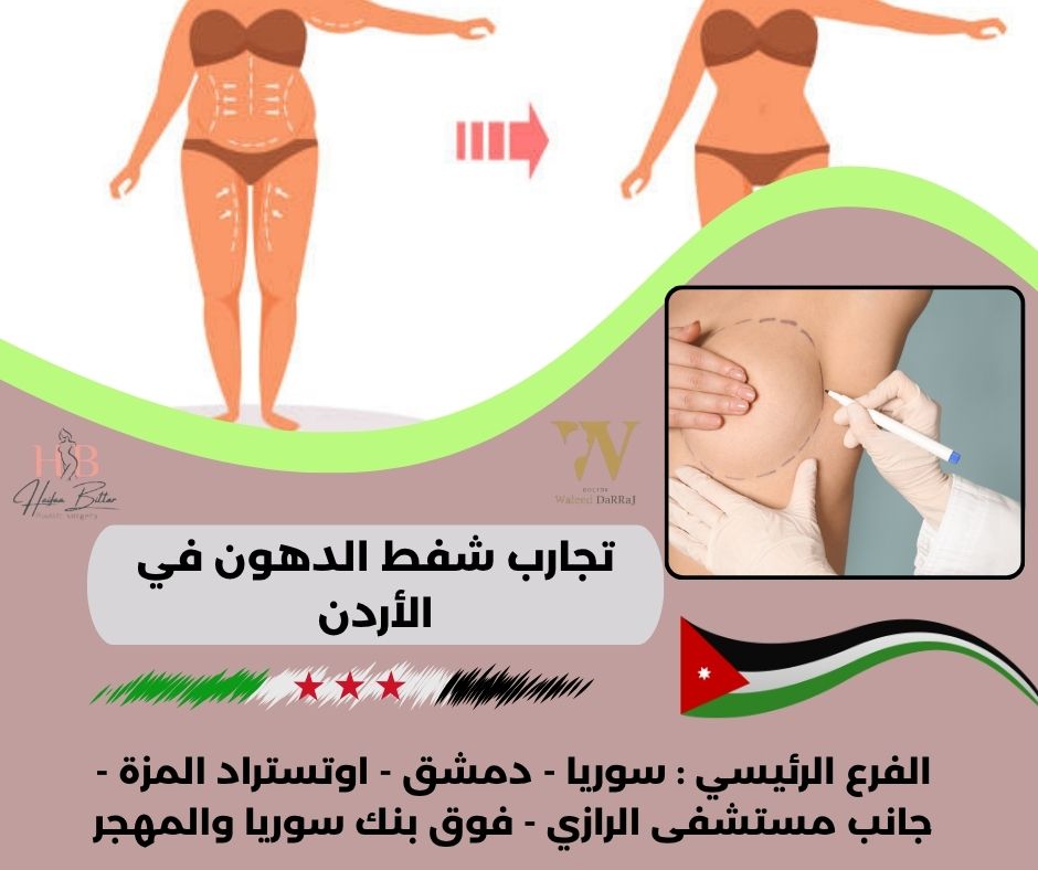 هل تجارب شفط الدهون في الأردن مؤلمة؟