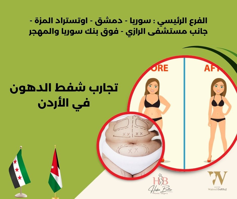 تكلفة شفط الدهون في الاردن