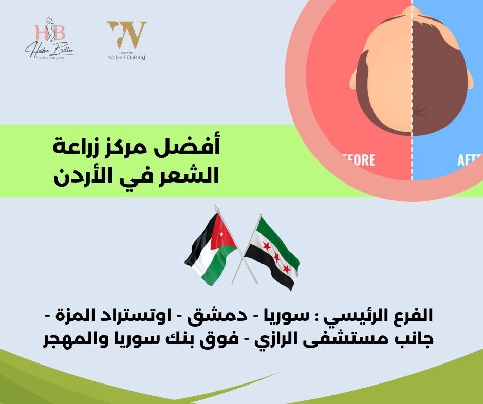 افضل مراكز زراعة الشعر في الاردن