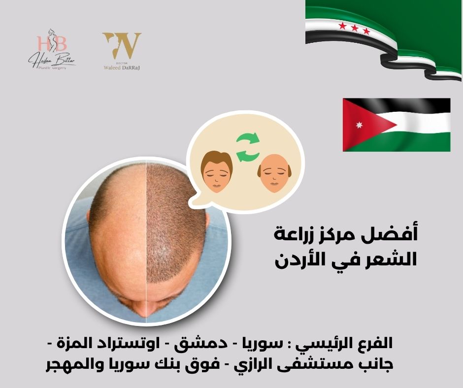 مركز زراعة الشعر في الاردن