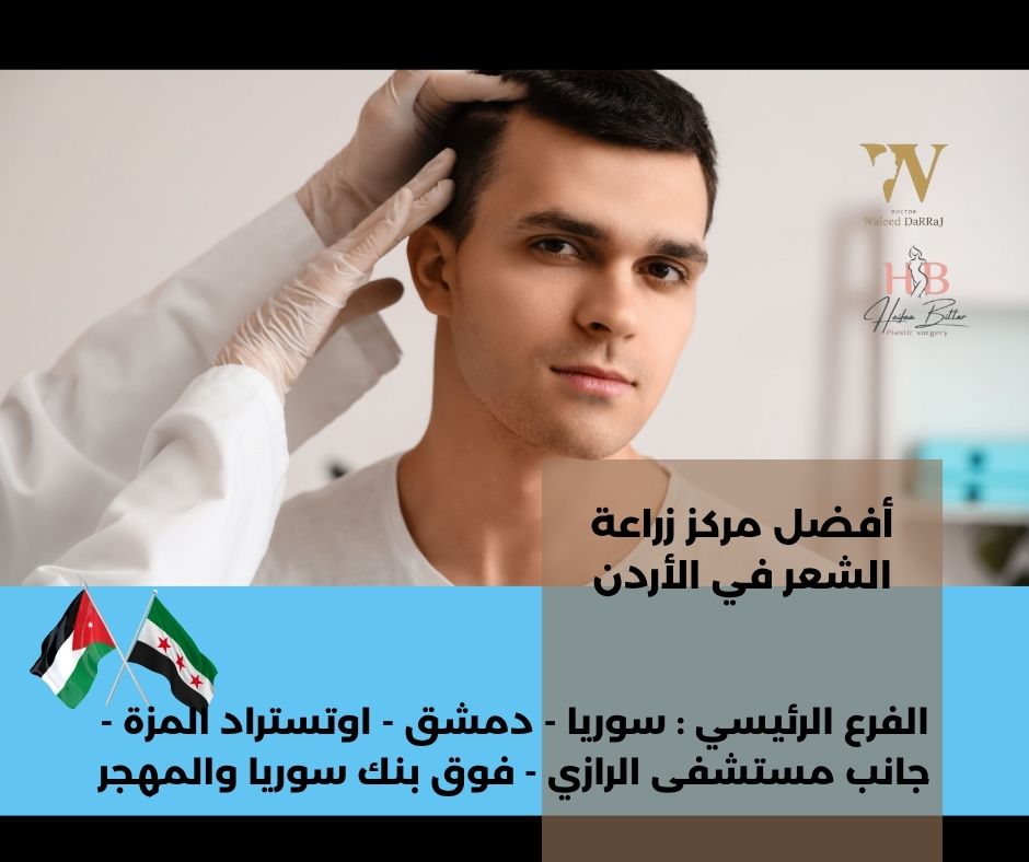 أفضل مركز زراعة الشعر في الأردن