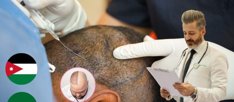 أفضل مركز زراعة الشعر في الأردن