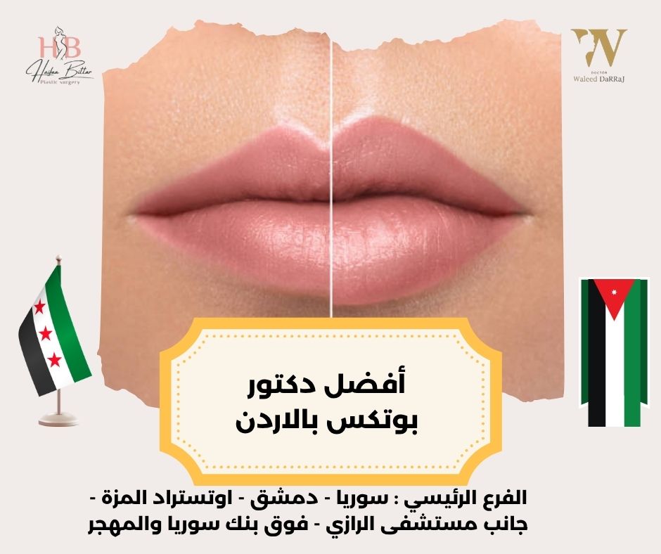 أفضل دكتور فيلر في الأردن أفضل دكتور فيلر في الأردن