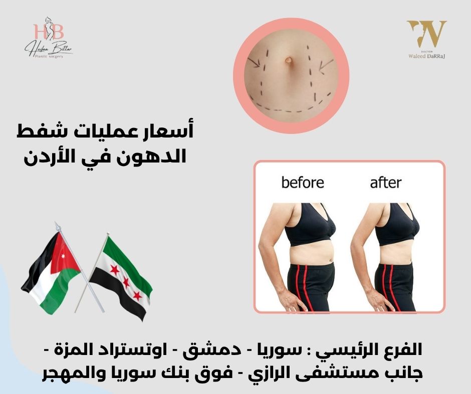 تكلفة عمليات شفط الدهون في الاردن تكلفة عمليات شفط الدهون في الاردن