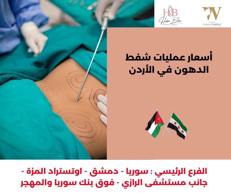 أسعار عمليات شفط الدهون في الأردن أسعار عمليات شفط الدهون في الأردن