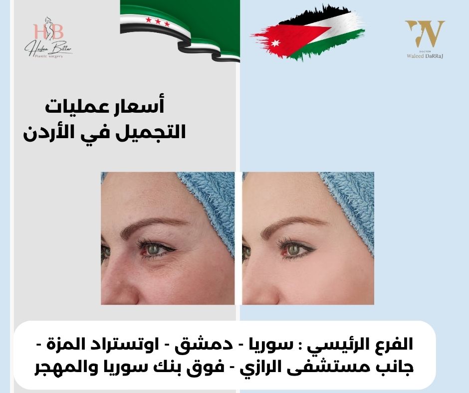 افضل دكتورة تجميل في عمان