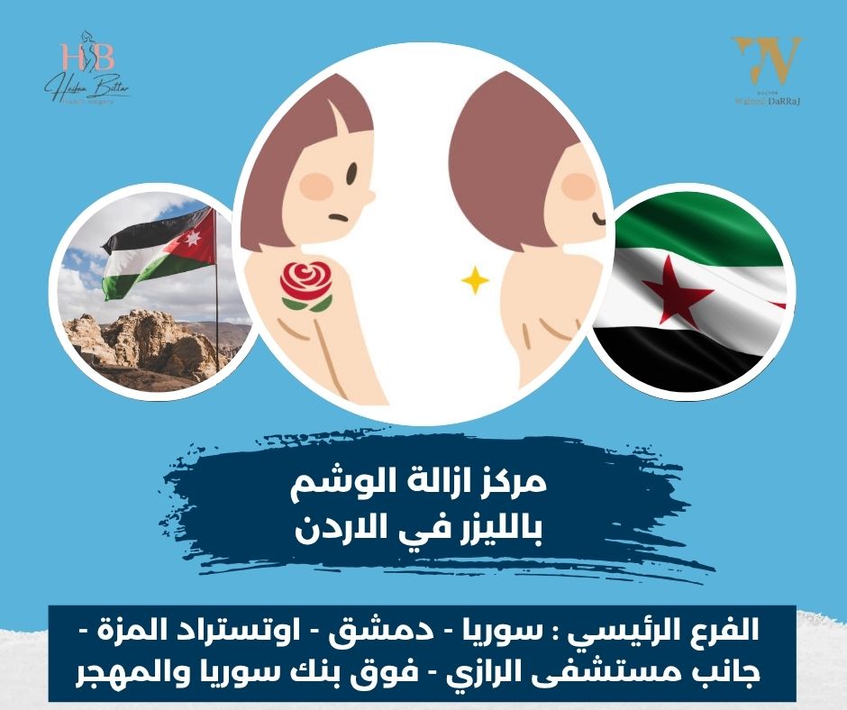 أسعار إزالة الوشم بالليزر في الاردن