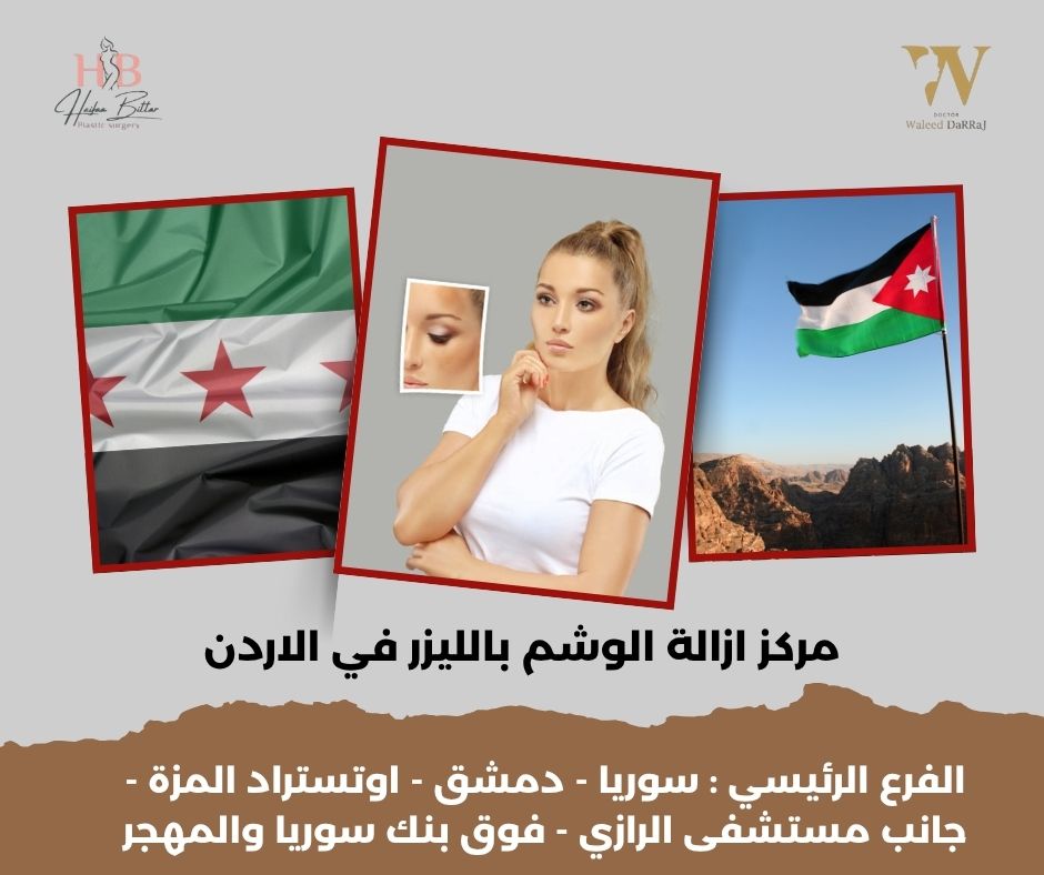 أسعار إزالة الوشم بالليزر في الأردن