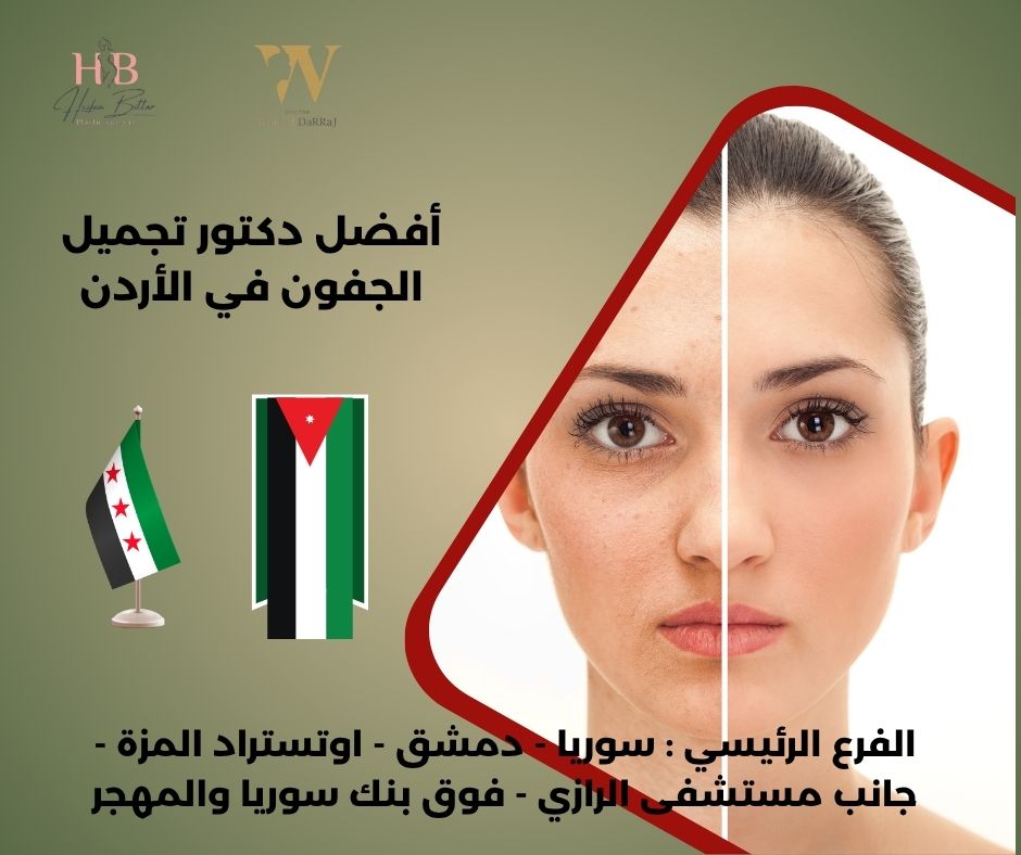 أفضل دكتور تجميل الجفون في الأردن
