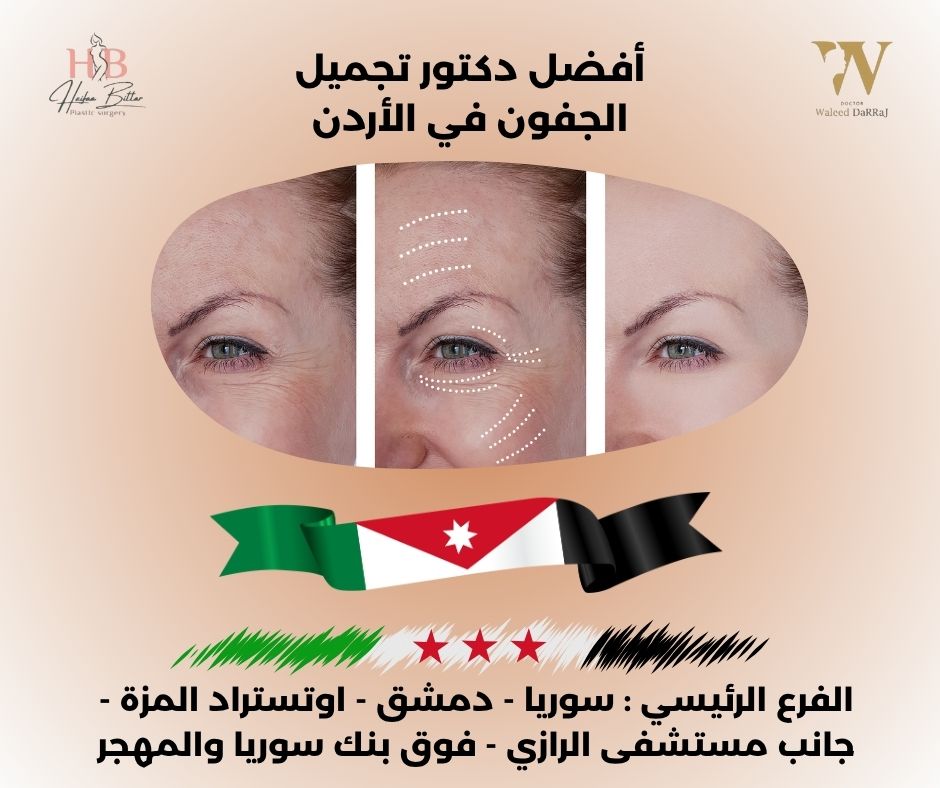 تكلفة عملية شد الجفون في الأردن