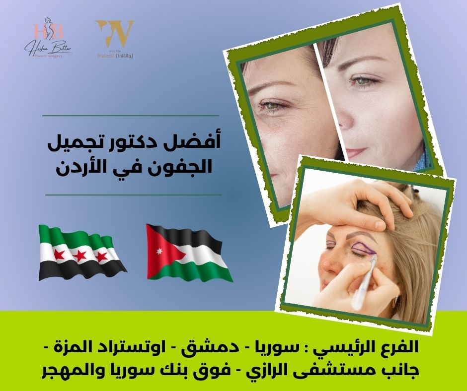 أفضل دكتور شد الجفون