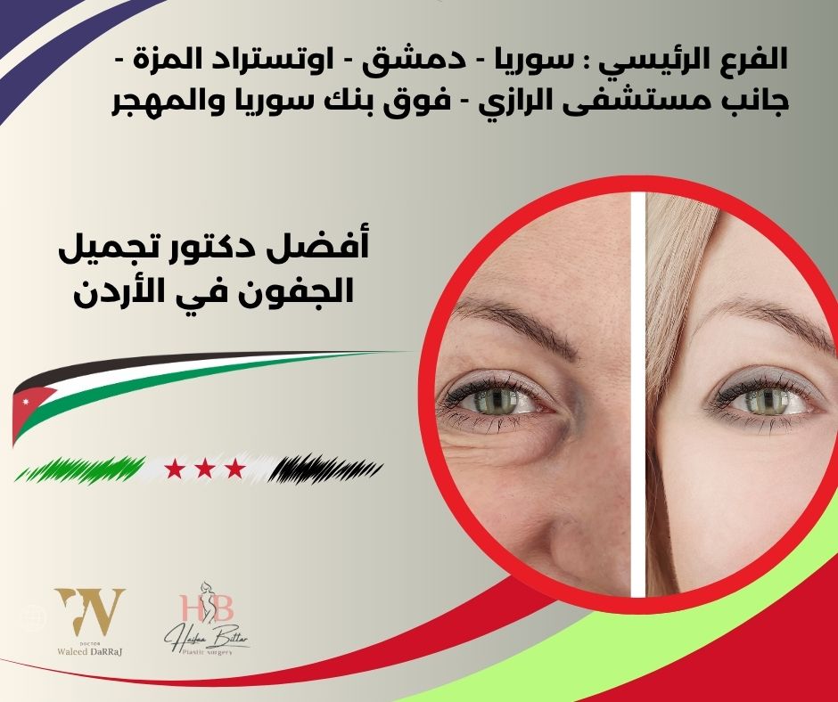 آراء بعض المرضى حول أفضل دكتور تجميل الجفون في الأردن