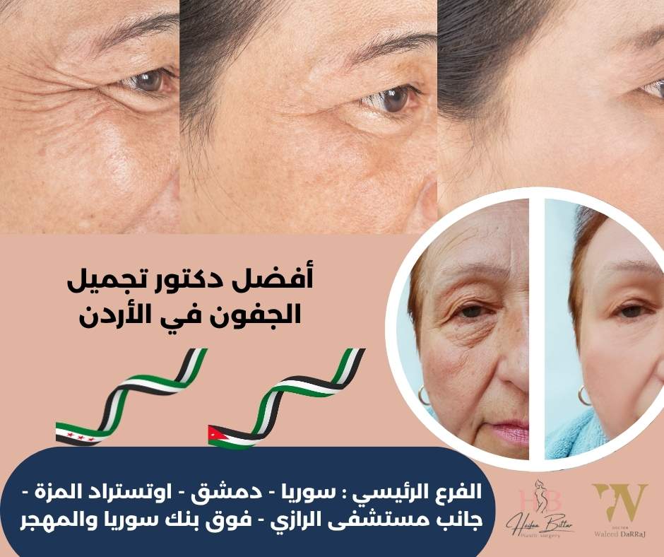 أفضل دكتور تجميل الجفون في الأردن