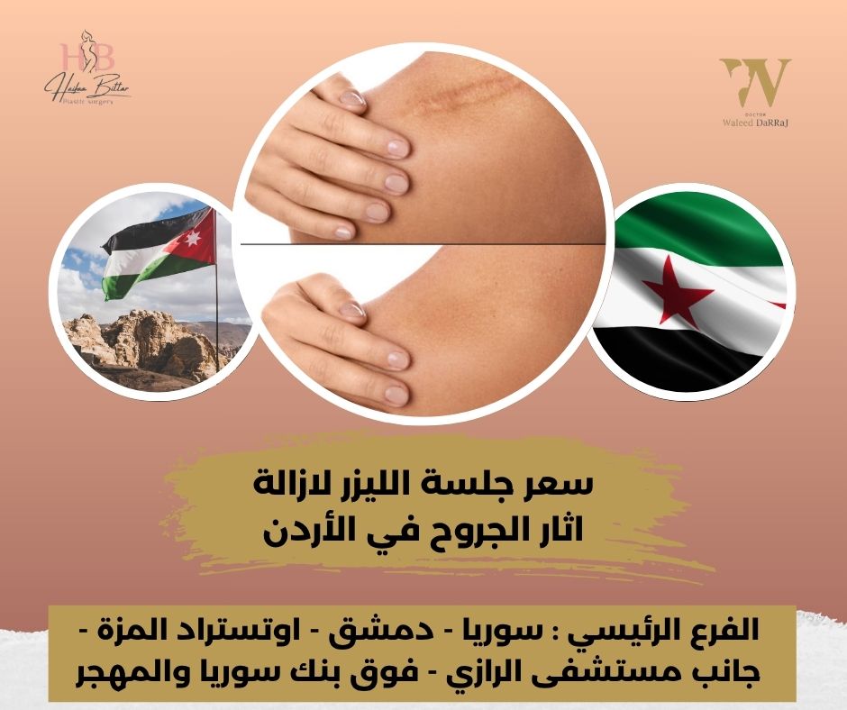 كم جلسة ليزر تحتاج الندبات؟