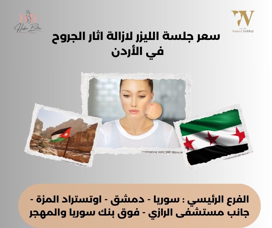 أسعار جلسات الليزر لازالة آثار حب الشباب في الأردن