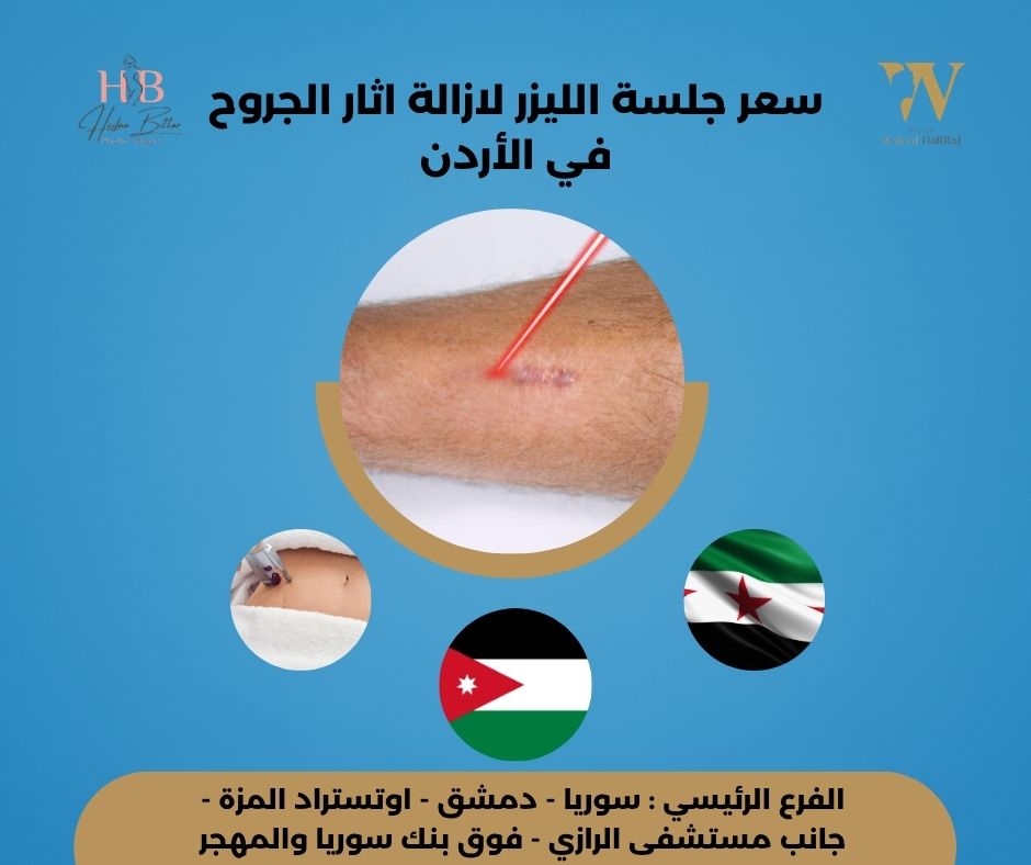 تكلفة إزالة اثار الجروح بالليزر في الأردن