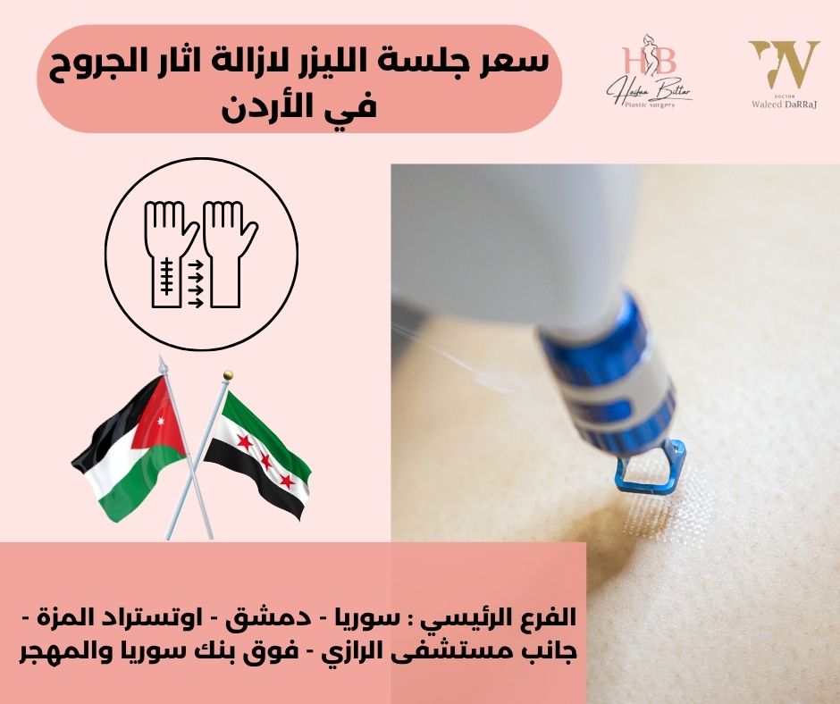 سعر جلسة الليزر لازالة اثار الجروح في الأردن
