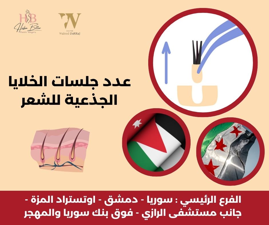 الخلايا المجهرية للشعر في الاردن